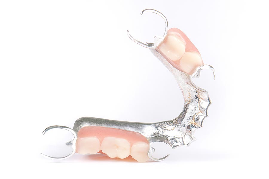 Dentures & False Teeth Auckland, Auckland Denture Clinic, Dentures Auckland